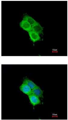 Immunocytochemistry/ Immunofluorescence - Anti-OXSR1 antibody (AB97694)