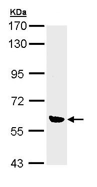 Western blot - Anti-OXSR1 antibody (AB97694)