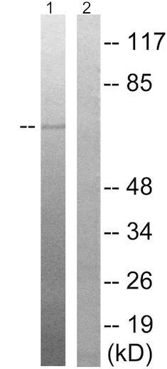 Western blot - Anti-OXSR1 (phospho T185) antibody (AB192803)