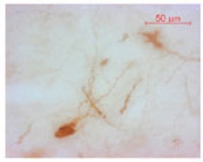 Immunohistochemistry (Frozen sections) - Anti-Oxytocin-neurophysin 1 antibody (AB228508)
