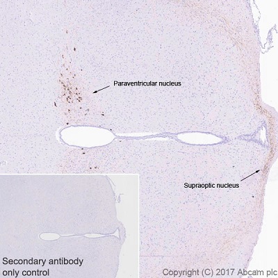Immunohistochemistry (Formalin/PFA-fixed paraffin-embedded sections) - Anti-Oxytocin-neurophysin 1 antibody [EPR20973] (AB212193), expandable thumbnail