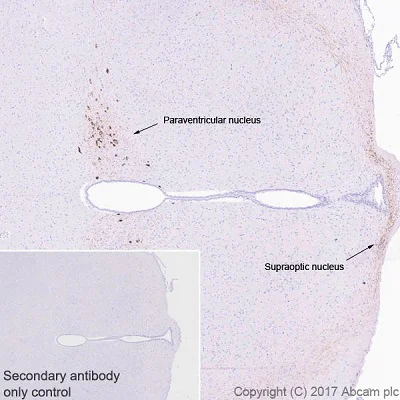 Immunohistochemistry (Formalin/PFA-fixed paraffin-embedded sections) - Anti-Oxytocin-neurophysin 1 antibody [EPR20973] (AB212193)