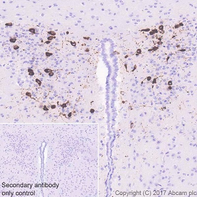 Immunohistochemistry (Formalin/PFA-fixed paraffin-embedded sections) - Anti-Oxytocin-neurophysin 1 antibody [EPR20973] (AB212193), expandable thumbnail