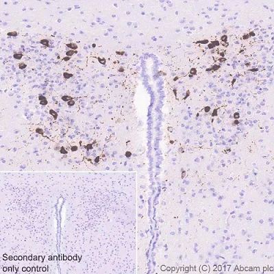 Immunohistochemistry (Formalin/PFA-fixed paraffin-embedded sections) - Anti-Oxytocin-neurophysin 1 antibody [EPR20973] (AB212193)