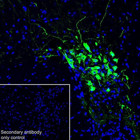 Immunohistochemistry (Frozen sections) - Anti-Oxytocin-neurophysin 1 antibody [EPR20973] - BSA and Azide free (AB226490), expandable thumbnail
