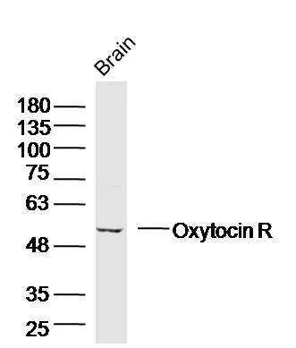 Western blot - Anti-Oxytocin Receptor antibody (AB217212)