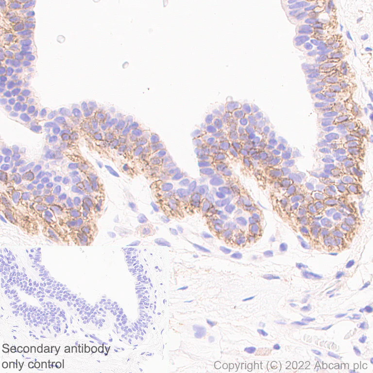 Immunohistochemistry (Formalin/PFA-fixed paraffin-embedded sections) - Anti-P cadherin antibody [56/P-Cadherin] (AB307740)
