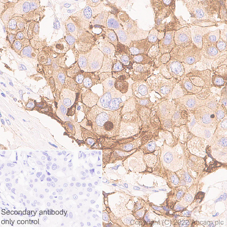 Immunohistochemistry (Formalin/PFA-fixed paraffin-embedded sections) - Anti-P cadherin antibody [56/P-Cadherin] (AB307740)