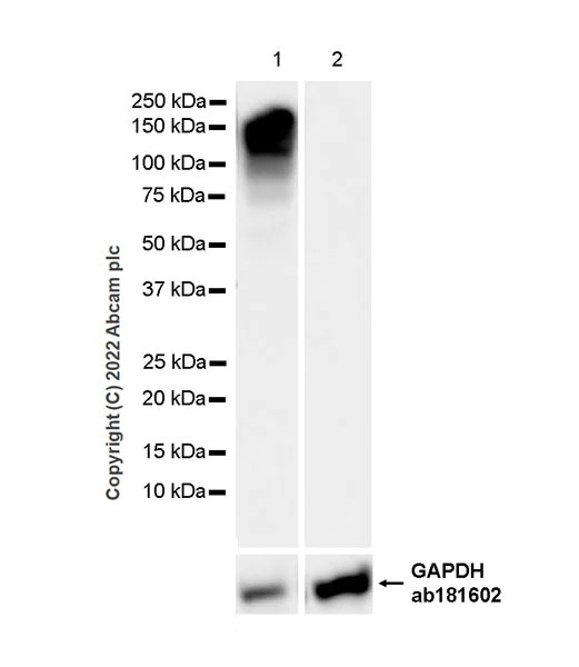 Western blot - Anti-P cadherin antibody [56/P-Cadherin] (AB307740)