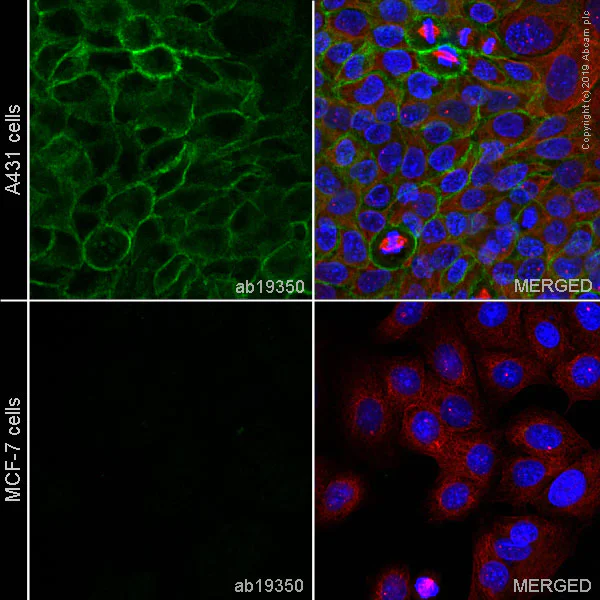 Immunocytochemistry/ Immunofluorescence - Anti-P cadherin antibody [6A9] - BSA and Azide free (AB233769)