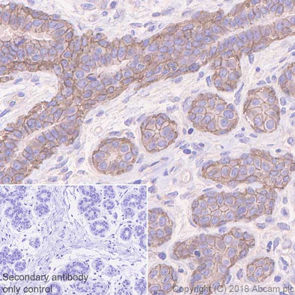 Immunohistochemistry (Formalin/PFA-fixed paraffin-embedded sections) - Anti-P cadherin antibody [EPR22426] (AB242060), expandable thumbnail