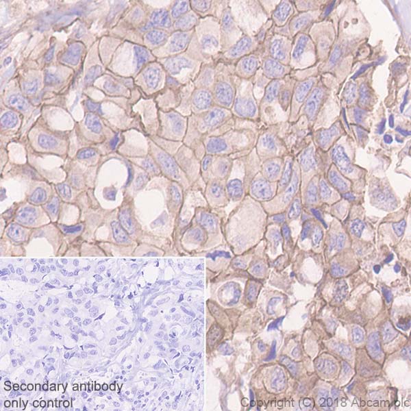 Immunohistochemistry (Formalin/PFA-fixed paraffin-embedded sections) - Anti-P cadherin antibody [EPR22426] (AB242060), expandable thumbnail