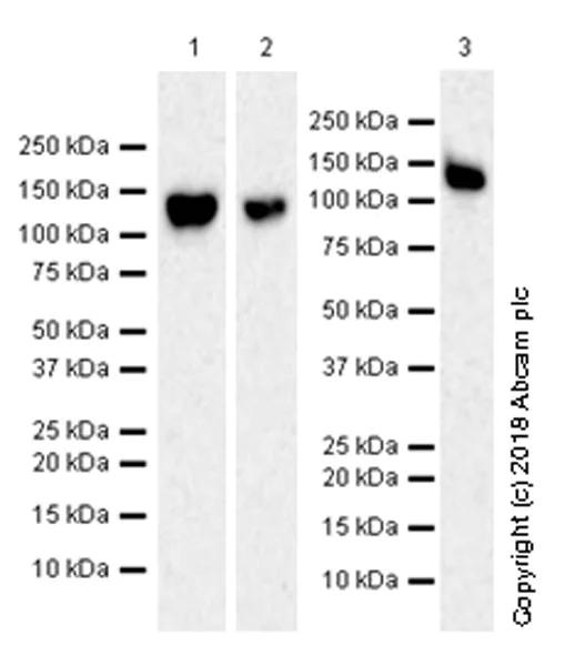 Western blot - Anti-P cadherin antibody [EPR22426] (AB242060)