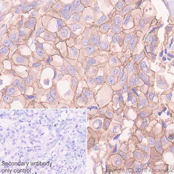 Immunohistochemistry (Formalin/PFA-fixed paraffin-embedded sections) - Anti-P cadherin antibody [EPR22426] - BSA and Azide free (AB245204)