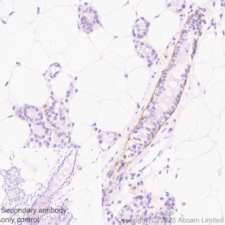 Immunohistochemistry (Formalin/PFA-fixed paraffin-embedded sections) - Anti-P cadherin antibody [EPR30043-509] (AB324980)