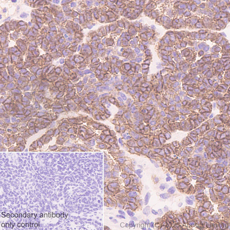 Immunohistochemistry (Formalin/PFA-fixed paraffin-embedded sections) - Anti-P cadherin antibody [EPR30043-509] (AB324980)