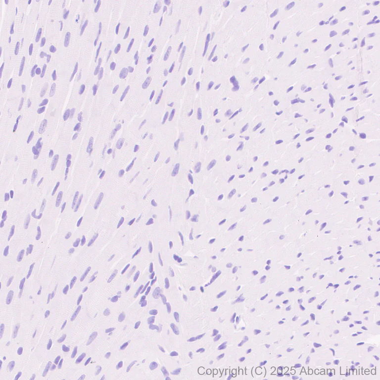 Immunohistochemistry (Formalin/PFA-fixed paraffin-embedded sections) - Anti-P cadherin antibody [EPR30043-509] (AB324980)