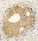 Immunohistochemistry (Formalin/PFA-fixed paraffin-embedded sections) - Anti-P cadherin antibody - N-terminal (AB190076)