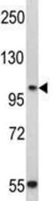 Western blot - Anti-P cadherin antibody - N-terminal (AB190076)