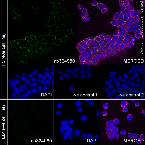 Immunocytochemistry/ Immunofluorescence - Anti-P cadherin antibody[EPR30043-509] - BSA and Azide free (AB324985)
