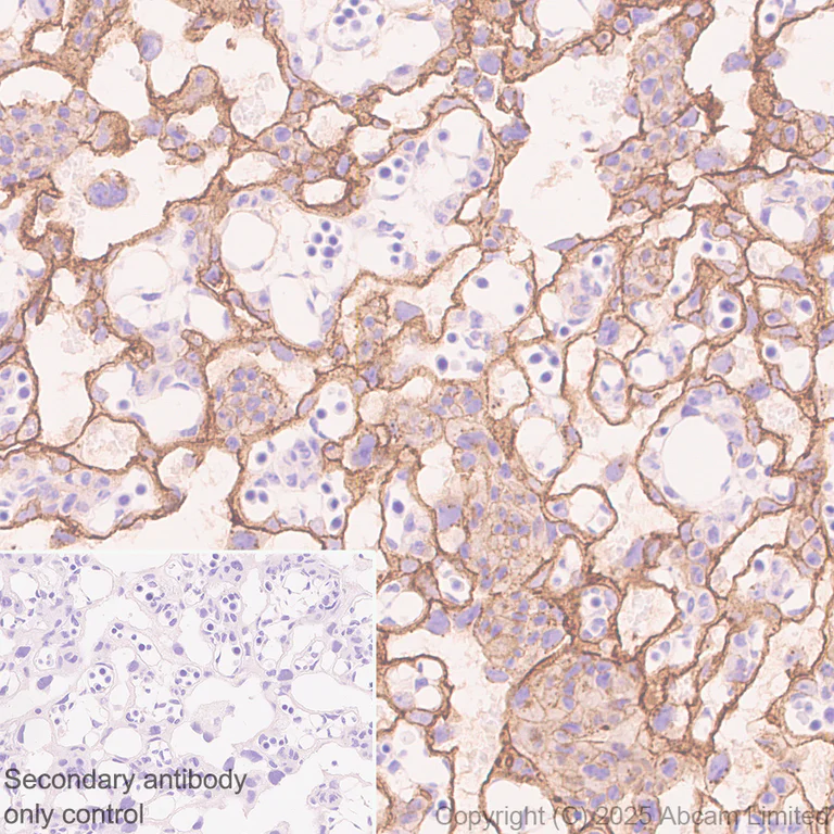 Immunohistochemistry (Formalin/PFA-fixed paraffin-embedded sections) - Anti-P cadherin antibody[EPR30043-509] - BSA and Azide free (AB324985)