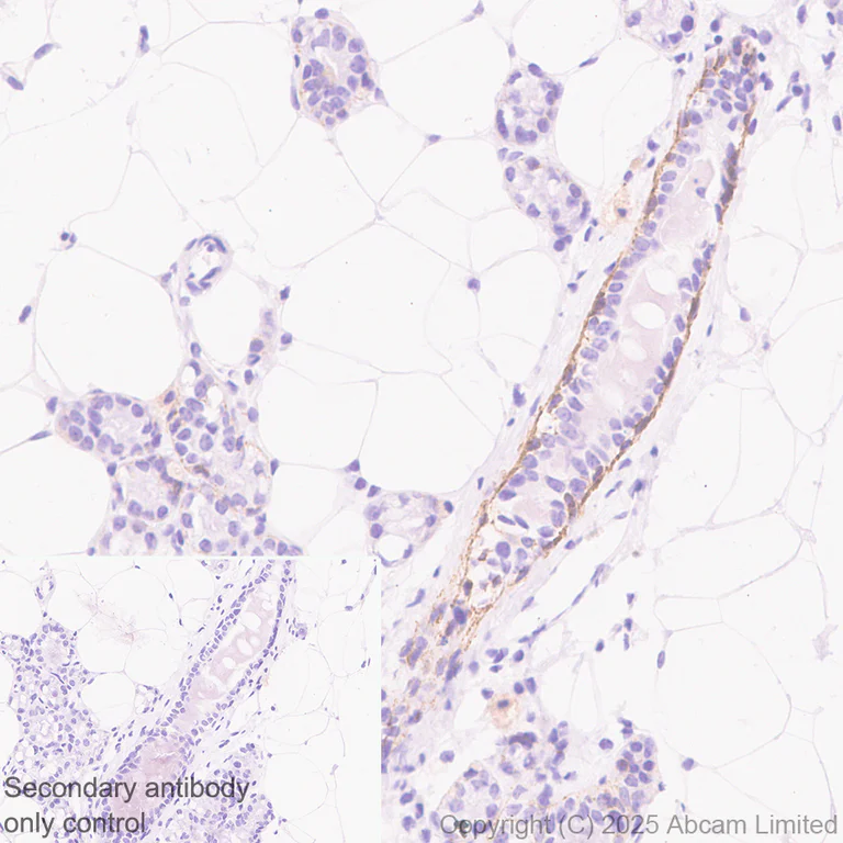 Immunohistochemistry (Formalin/PFA-fixed paraffin-embedded sections) - Anti-P cadherin antibody[EPR30043-509] - BSA and Azide free (AB324985)