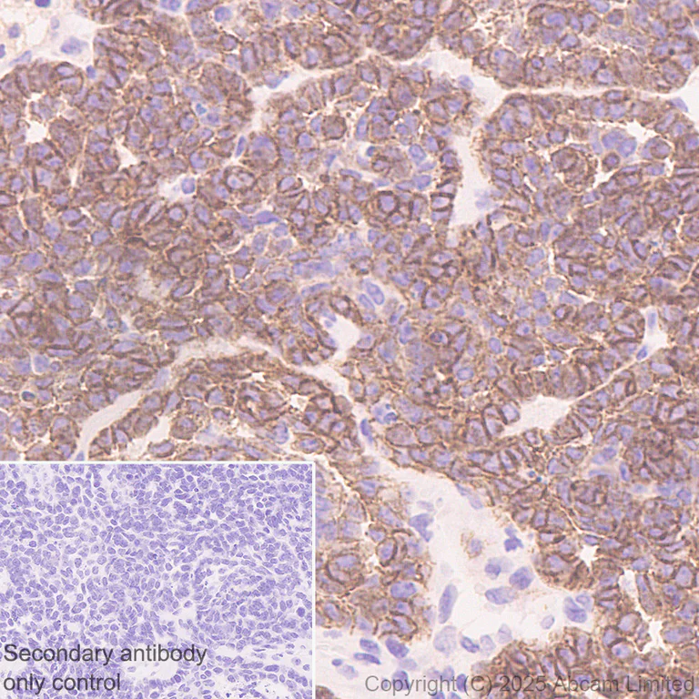 Immunohistochemistry (Formalin/PFA-fixed paraffin-embedded sections) - Anti-P cadherin antibody[EPR30043-509] - BSA and Azide free (AB324985)