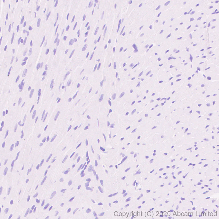 Immunohistochemistry (Formalin/PFA-fixed paraffin-embedded sections) - Anti-P cadherin antibody[EPR30043-509] - BSA and Azide free (AB324985)