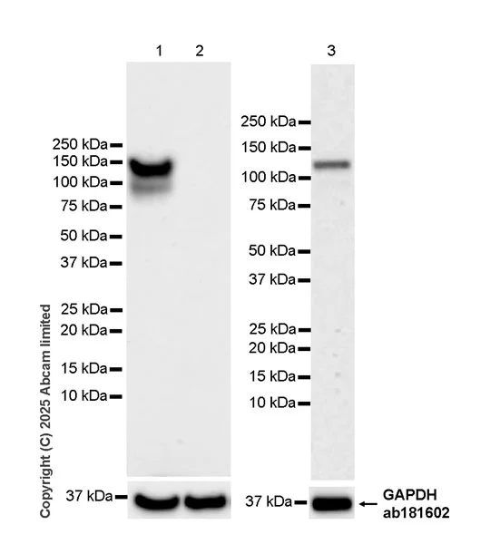 Western blot - Anti-P cadherin antibody[EPR30043-509] - BSA and Azide free (AB324985)