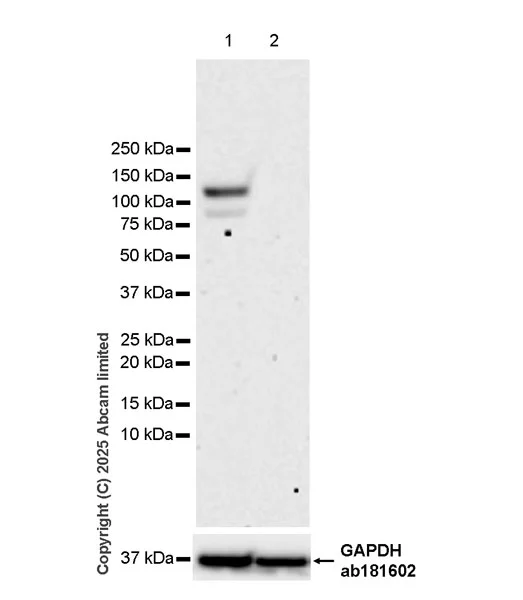 Western blot - Anti-P cadherin antibody[EPR30043-509] - BSA and Azide free (AB324985)