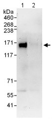 Immunoprecipitation - Anti-P Glycoprotein antibody (AB129450), expandable thumbnail