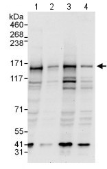 Western blot - Anti-P Glycoprotein antibody (AB129450), expandable thumbnail