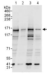 Western blot - Anti-P Glycoprotein antibody (AB129450)