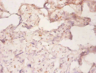 Immunohistochemistry (Formalin/PFA-fixed paraffin-embedded sections) - Anti-P Glycoprotein antibody (AB235954)