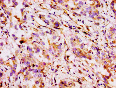 Immunohistochemistry (Formalin/PFA-fixed paraffin-embedded sections) - Anti-P Glycoprotein antibody (AB235954)
