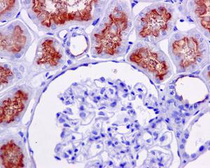 Immunohistochemistry (Formalin/PFA-fixed paraffin-embedded sections) - Anti-P Glycoprotein antibody [EPR10363] - BSA and Azide free (AB271923), expandable thumbnail