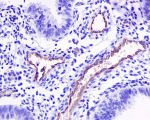 Immunohistochemistry (Formalin/PFA-fixed paraffin-embedded sections) - Anti-P Glycoprotein antibody [EPR10363] - BSA and Azide free (AB271923)