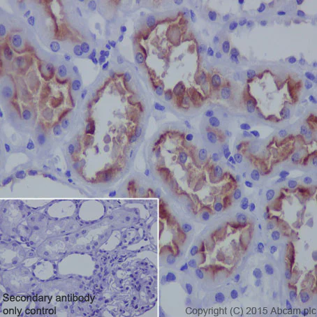 Immunohistochemistry (Formalin/PFA-fixed paraffin-embedded sections) - Anti-P Glycoprotein antibody [EPR10363] - BSA and Azide free (AB271923)