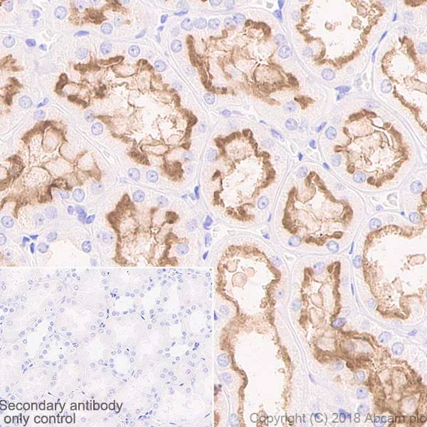 Immunohistochemistry (Formalin/PFA-fixed paraffin-embedded sections) - Anti-P Glycoprotein antibody [EPR10364-57] (AB170904)