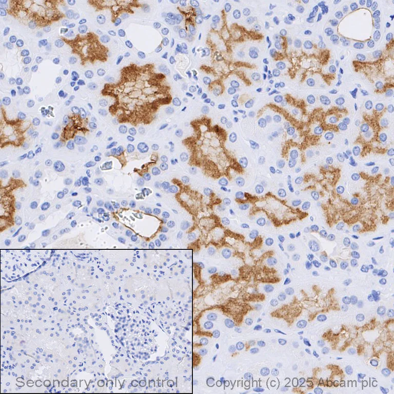 Immunohistochemistry (Formalin/PFA-fixed paraffin-embedded sections) - Anti-P Glycoprotein antibody [EPR10364-57] (AB170904)