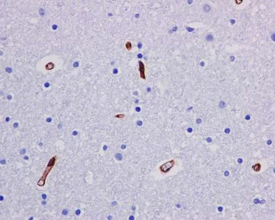 Immunohistochemistry (Formalin/PFA-fixed paraffin-embedded sections) - Anti-P Glycoprotein antibody [EPR10364-57] (AB170904)