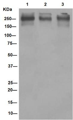 Western blot - Anti-P Glycoprotein antibody [EPR10364-57] (ab170904), expandable thumbnail