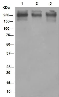 Western blot - Anti-P Glycoprotein antibody [EPR10364-57] (AB170904)