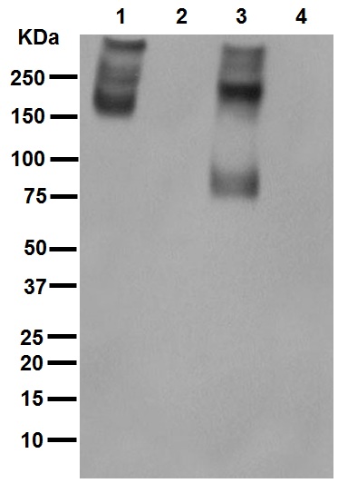 Western blot - Anti-P Glycoprotein antibody [EPR10364-57] (ab170904), expandable thumbnail