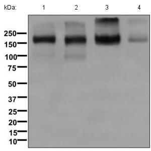 Western blot - Anti-P Glycoprotein antibody [EPR10364-57] (ab170904), expandable thumbnail