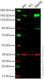 Western blot - Anti-P Glycoprotein antibody [EPR10364-57] (AB170904)