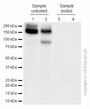 Western blot - Anti-P Glycoprotein antibody [EPR10364-57] (AB170904), expandable thumbnail
