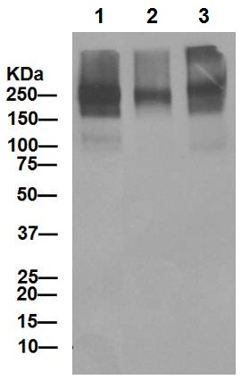 Western blot - Anti-P Glycoprotein antibody [EPR10364-57] (ab170904), expandable thumbnail