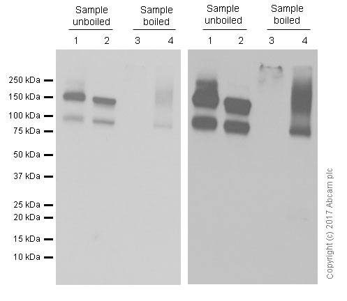 Western blot - Anti-P Glycoprotein antibody [EPR10364-57] (ab170904), expandable thumbnail
