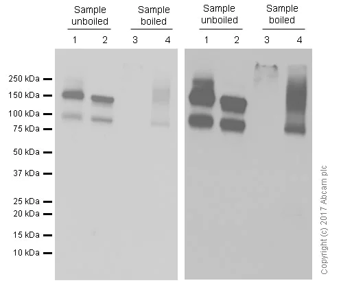 Western blot - Anti-P Glycoprotein antibody [EPR10364-57] (AB170904)